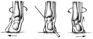 images-12