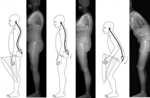 3175930_586_2011_1937_Fig15_HTML