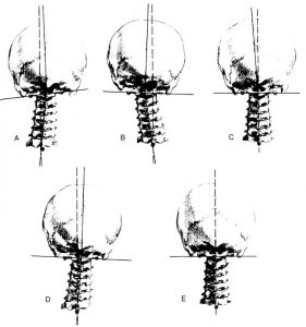 Atlas-4-types