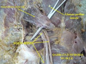 800px-sciatic_nerve