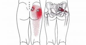 piriformis-stretches-sciatica
